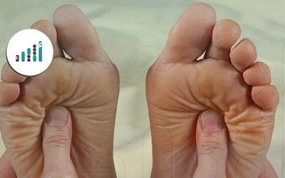 5 أسباب للشعور المتكرر بوخز في الأقدام